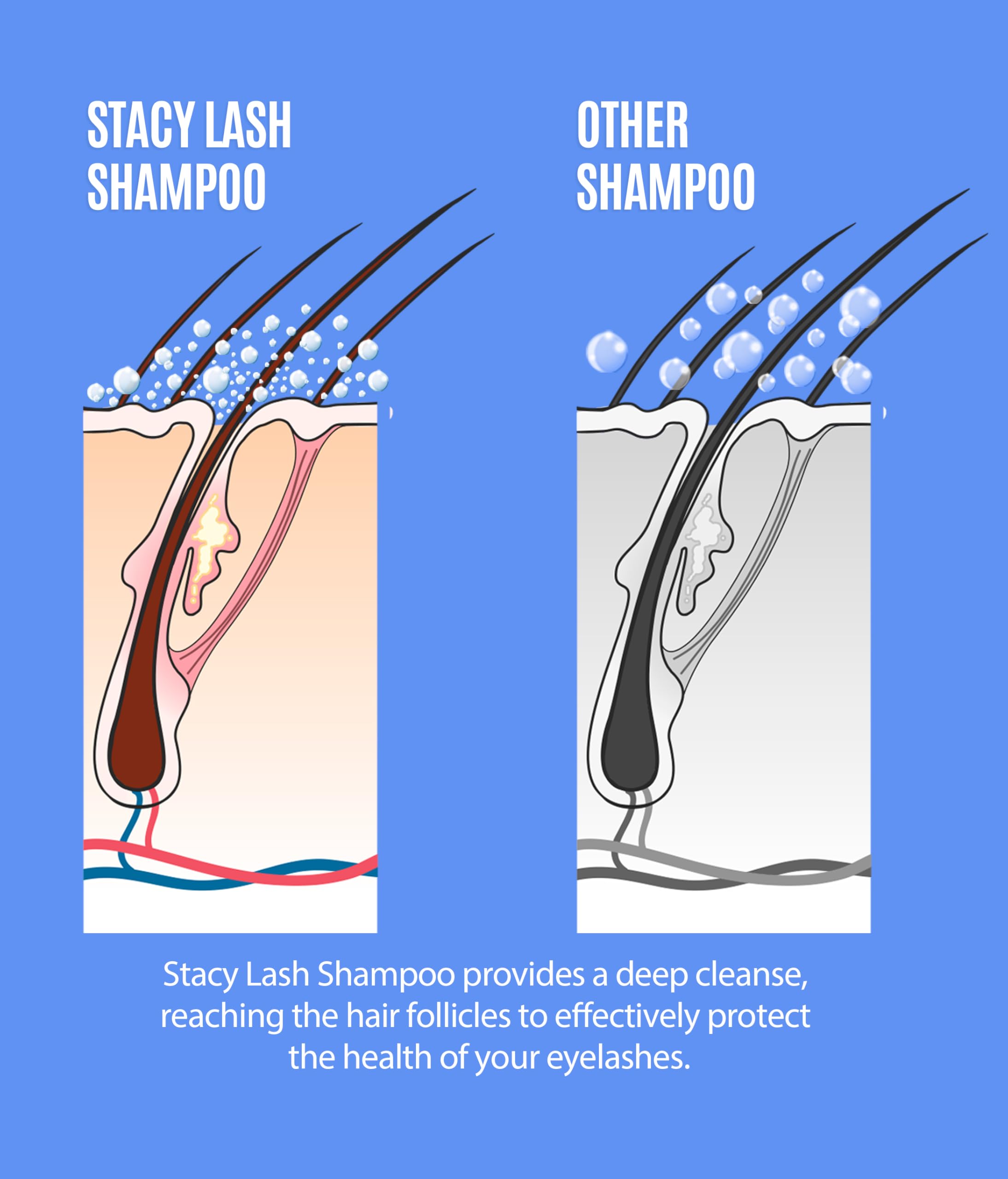 STACY LASH Eyelash Extension Shampoo + Brush / 1.69 fl.oz / 50ml / Eyelid Foaming Cleanser/Wash for Extensions & Natural Lashes/Safe Makeup Remover/Supplies for Professional & Home Use