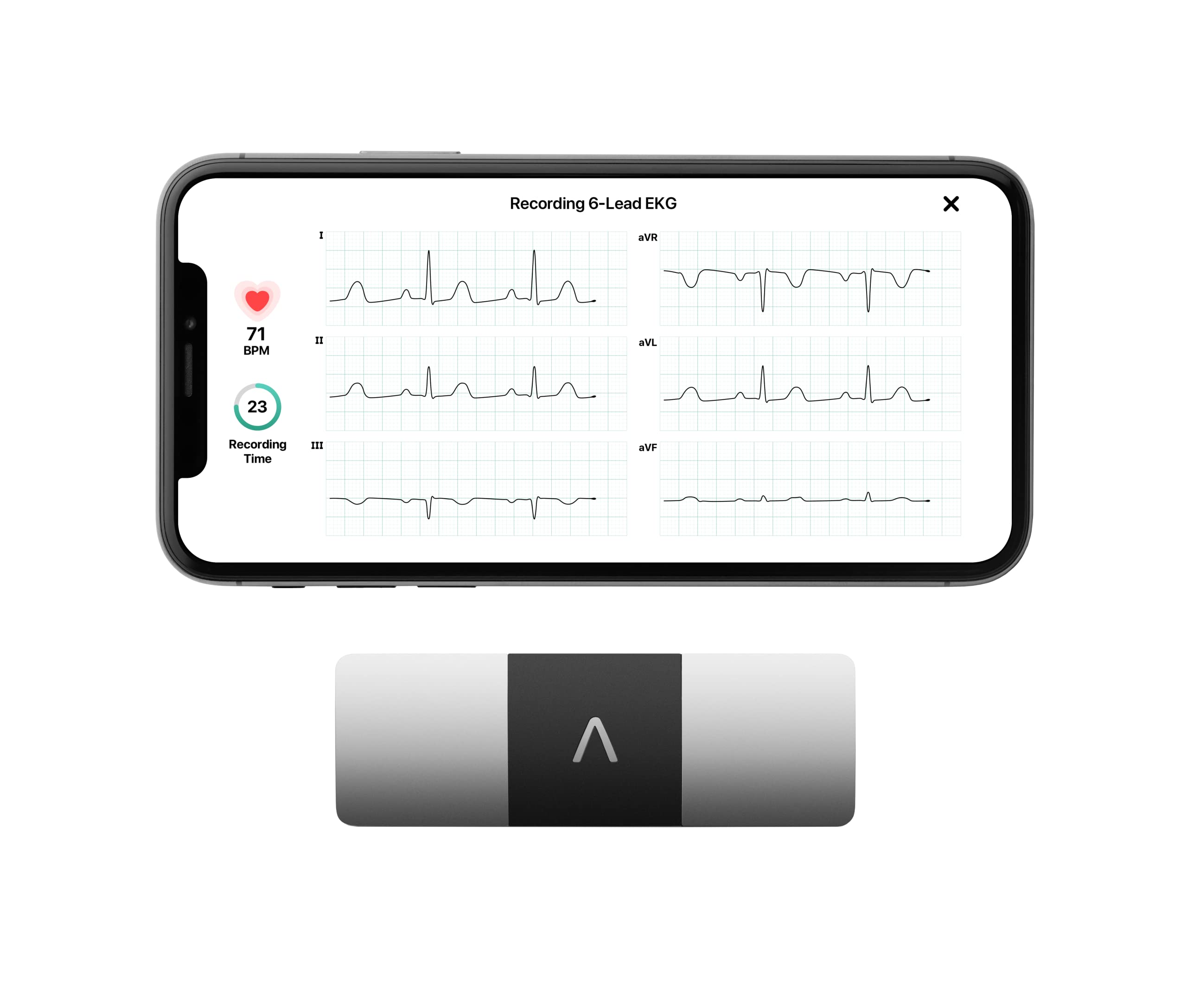 KardiaMobile 6-Lead Personal EKG Monitor - Six Views of The Heart - Detects AFib and Irregular Arrhythmias - Instant Results in 30 Seconds - Works with Most Smartphones
