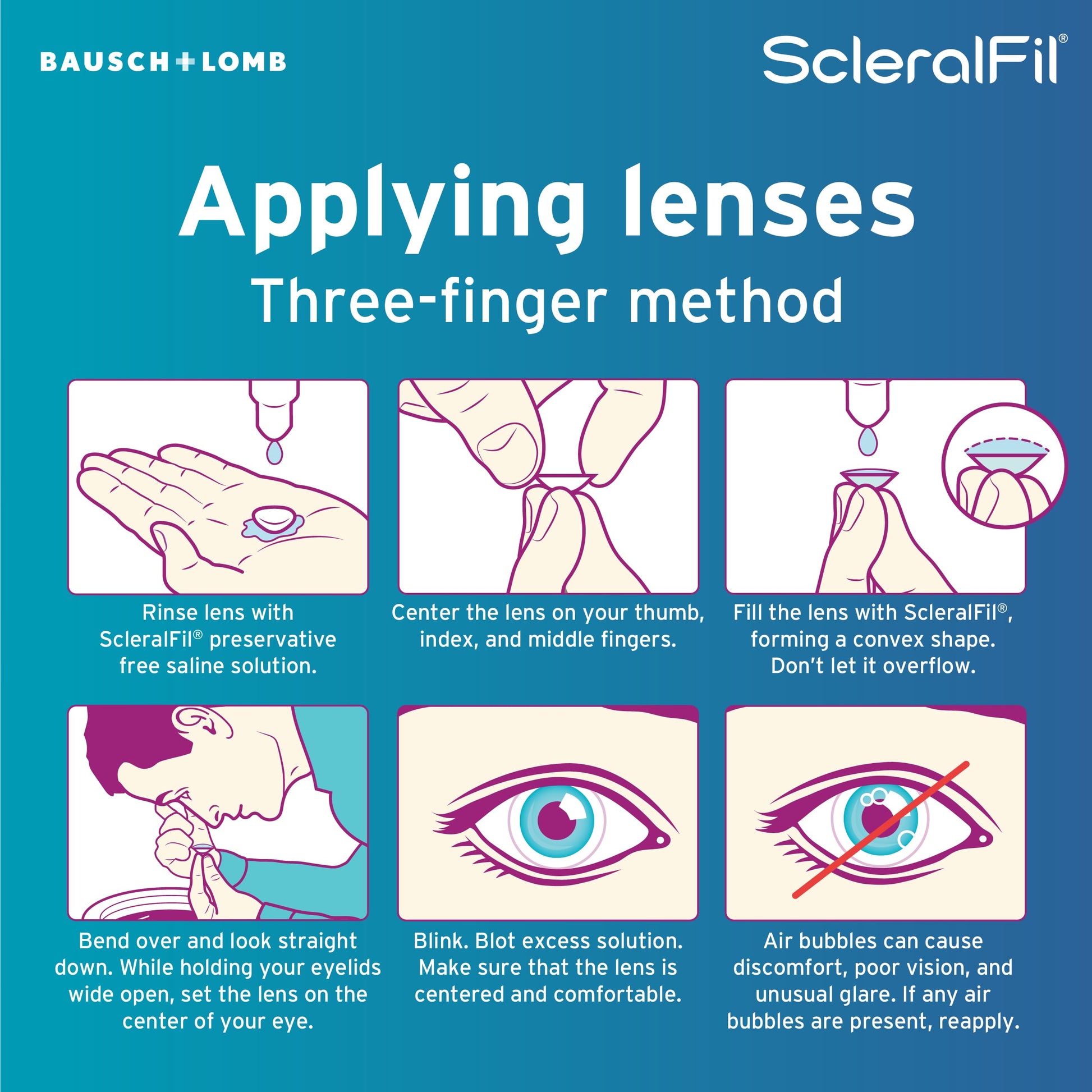 ScleralFil Preservative Free Saline Solution for Scleral Lenses, Buffered Isotonic Rinsing & Insertion Solution for Soft and Rigid Gas Permeable Contacts, Single-Use Vials, 30 Count