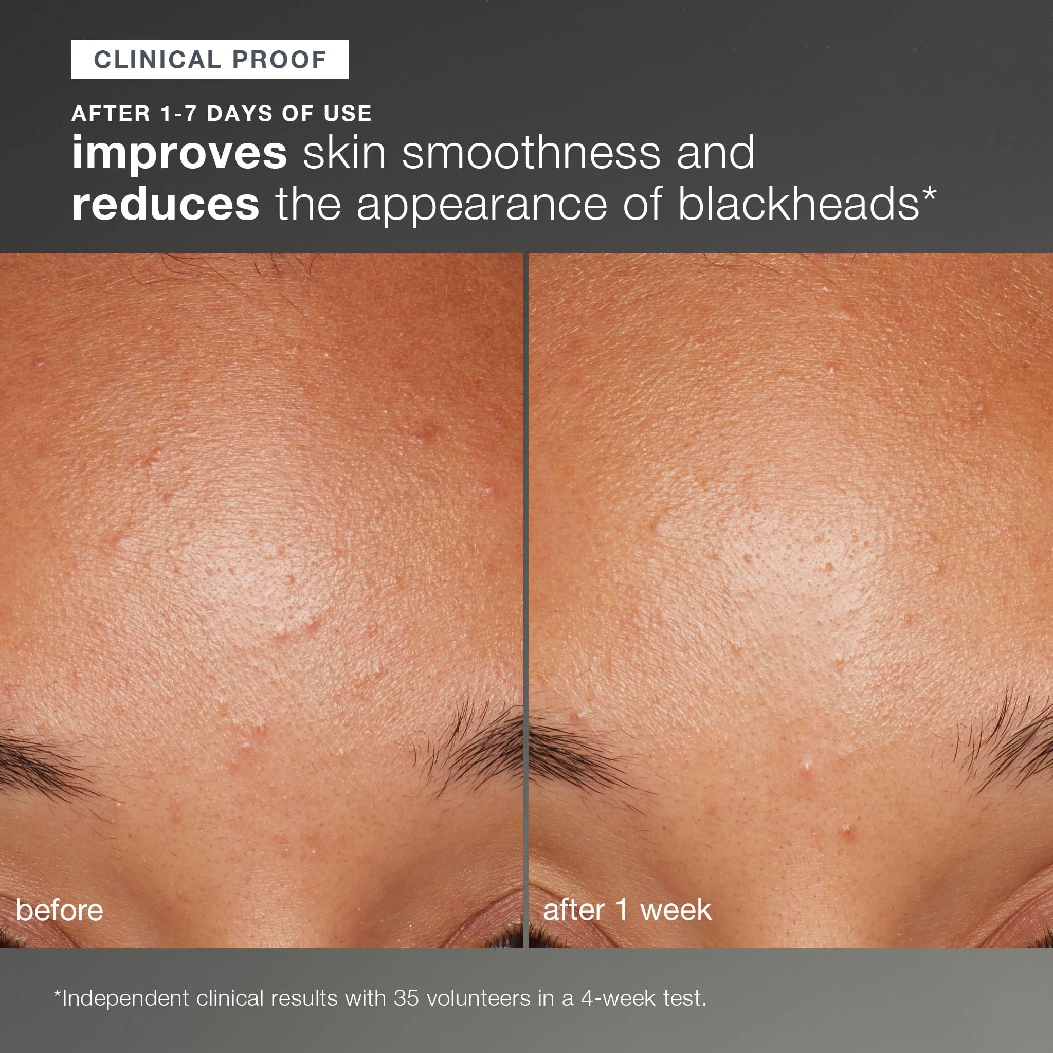 Dermalogica Daily Microfoliant, Face Exfoliator Scrub Powder with Salicylic Acid and Papaya Enzyme, Achieve Brighter, Smoother Skin Daily