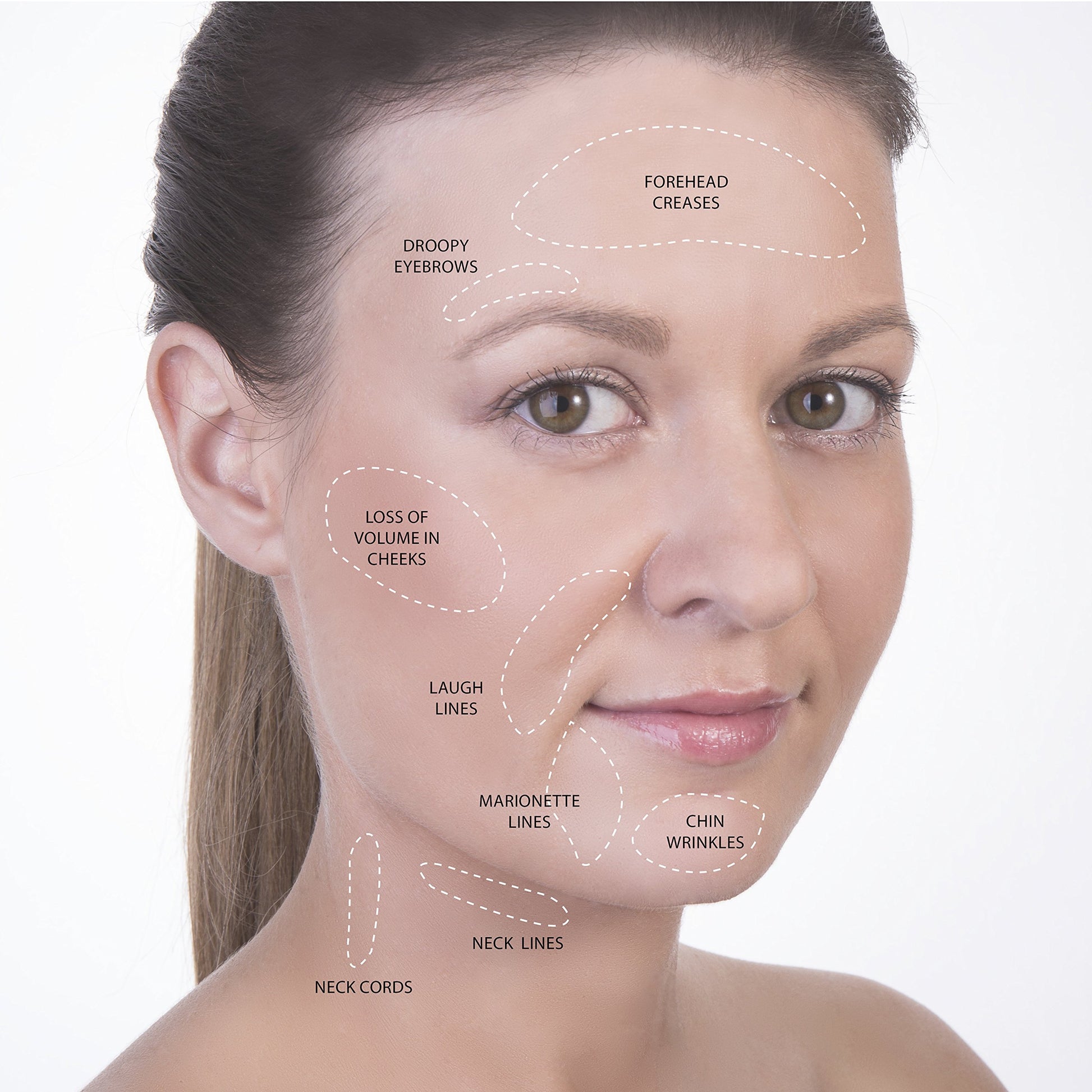 Cupping Therapy Sets - Face Cupping Set - Double Chin Reducer - Facial Cupping System - Silicone Massage Cups - Cupping for Cellulite Kit - Ideal to Shape your Cheeks and Chin - by Sandine (Pink)